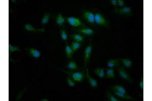 Immunofluorescence staining of Hela cells with ABIN7149425 at 1:266, counter-stained with DAPI. (NT5C2 Antikörper  (AA 487-553))