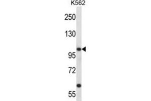 Western Blotting (WB) image for anti-Potassium Voltage-Gated Channel, Shaw-Related Subfamily, Member 3 (KCNC3) antibody (ABIN2998065) (KCNC3 Antikörper)