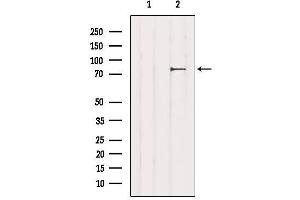 Western blot analysis of extracts from 3T3, using CHAT Antibody. (Choline Acetyltransferase Antikörper  (C-Term))