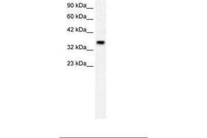 Image no. 2 for anti-Forkhead Box F1 (FOXF1) (AA 292-341) antibody (ABIN202327) (FOXF1 Antikörper  (AA 292-341))