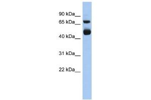 WB Suggested Anti-ALOX15 Antibody Titration: 0. (ALOX15 Antikörper  (Middle Region))
