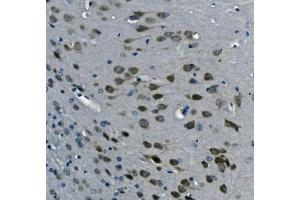 IHC analysis of PCBP2/hnRNP E2 using anti-PCBP2/hnRNP E2 antibody (ABIN7600449). (PCBP2 Antikörper  (AA 197-276))