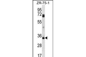 PDCD1LG2 Antibody (N-term) (ABIN656243 and ABIN2845559) western blot analysis in ZR-75-1 cell line lysates (35 μg/lane). (PDCD1LG2 Antikörper  (N-Term))