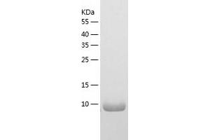 Western Blotting (WB) image for Growth Regulated Oncogene gamma (GRO gamma) (AA 28-100) protein (His tag) (ABIN7123220)