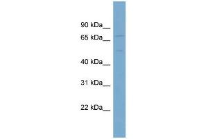 WB Suggested Anti-SLC7A1  Antibody Titration: 0. (SLC7A1 Antikörper  (N-Term))