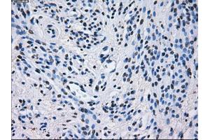 Immunohistochemical staining of paraffin-embedded liver tissue using anti-PSMA7mouse monoclonal antibody. (PSMA7 Antikörper)