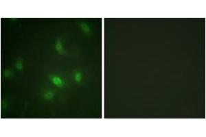 Immunofluorescence analysis of HepG2 cells, using STAT5A/B (Phospho-Ser725/730) Antibody. (STAT5 A/B Antikörper  (pSer726))