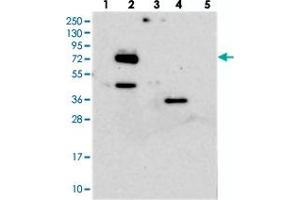 Western blot analysis of Lane 1: RT-4, Lane 2: U-251 MG, Lane 3: Human Plasma, Lane 4: Liver, Lane 5: Tonsil with EYA4 polyclonal antibody . (EYA4 Antikörper)