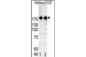 Western blot analysis of EGFR (arrow) in Hela cell lysates, either induced (Lane 1) or noninduced with EGF (Lane 2). (EGFR Antikörper  (pTyr1092))