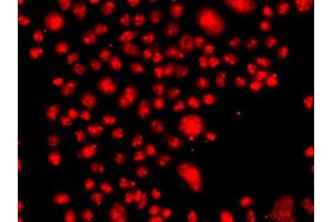 Immunofluorescence analysis of A549 cell using FANCM antibody. (FANCM Antikörper)