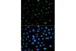 Immunofluorescence analysis of MCF7 cell using PSAP antibody. (Prosaposin Antikörper  (AA 60-310))