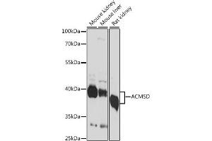 Western blot analysis of extracts of various cell lines, using ACMSD antibody (ABIN7265570) at 1:1000 dilution. (ACMSD Antikörper  (AA 1-336))