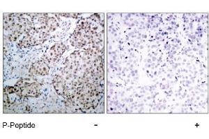 Image no. 3 for anti-Tumor Protein P53 (TP53) (pSer315) antibody (ABIN196788) (p53 Antikörper  (pSer315))
