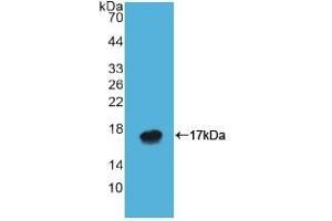 Detection of Recombinant ATP4a, Human using Polyclonal Antibody to ATPase, H+/K+ Exchanging Alpha Polypeptide (ATP4a) (ATP4A Antikörper  (AA 798-896))