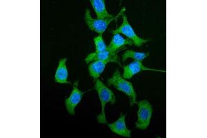 IF analysis of HGD using anti-HGD antibody (ABIN5693116). (HGD Antikörper  (AA 374-445))