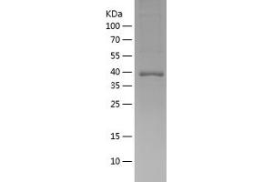 CAMK2D Protein (AA 2-115) (His-IF2DI Tag)