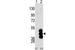 Western blot analysis of PHKG2 (arrow) using PHKG2 Antibody (N-term) . (PHKG2 Antikörper  (N-Term))