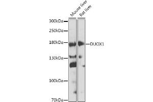 Western blot analysis of extracts of various cell lines, using DUOX1 antibody (ABIN6127816, ABIN6139857, ABIN6139858 and ABIN6224687) at 1:1000 dilution. (DUOX1 Antikörper  (AA 1312-1551))