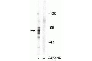Western blot of rat brain homogenate showing specific immunolabeling of the ~59 kDa, ~65 kDa, ~68 kDa Tau isoforms phosphorylated at Ser416 in the first lane (-). (MAPT Antikörper  (pSer416))
