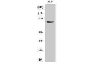 Western Blotting (WB) image for anti-Guanylate Cyclase 1 Soluble Subunit Alpha (GUCY1A1) (Internal Region) antibody (ABIN3184773)