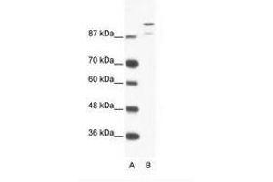 Image no. 1 for anti-HKR1, GLI-Kruppel Zinc Finger Family Member (HKR1) (AA 191-240) antibody (ABIN202856)