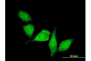 Immunofluorescence of purified MaxPab antibody to HDAC6 on HeLa cell.