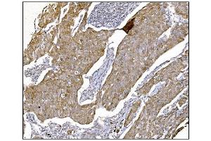IHC analysis of NDEL1 using anti-NDEL1 antibody (ABIN7602511). (NDEL1 Antikörper  (AA 80-320))