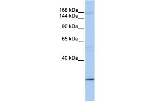 WB Suggested Anti-UBR2 Antibody Titration:  0. (UBR2 Antikörper  (C-Term))