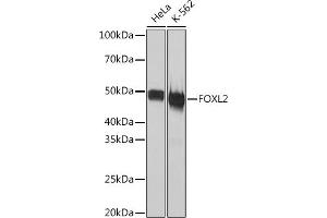 Western blot analysis of extracts of various cell lines, using FOXL2 Rabbit mAb (ABIN1682615, ABIN7101527, ABIN7101528 and ABIN7101529) at 1:1000 dilution.