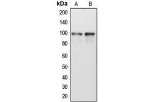 Western blot analysis of DDX54 expression in HeLa (A), Jurkat (B) whole cell lysates. (DDX54 Antikörper  (Center))