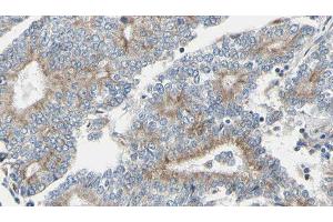 ABIN6275145 at 1/100 staining Human prostate tissue by IHC-P. (GCP6 Antikörper  (Internal Region))