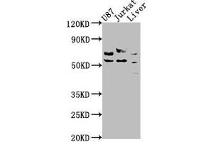Western Blot Positive WB detected in: U87 whole cell lysate, Jurkat whole cell lysate, Rat liver tissue All lanes: CDK5RAP3 antibody at 1:1000 Secondary Goat polyclonal to rabbit IgG at 1/50000 dilution Predicted band size: 57, 47, 32, 60 kDa Observed band size: 57 kDa (CDK5RAP3 Antikörper  (Regulatory Subunit))