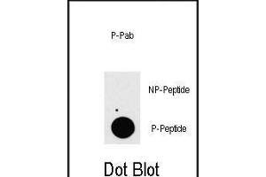 Dot blot analysis of anti-P3K7IP1-p Phospho-specific Pab (ABIN389806 and ABIN2839699) on nitrocellulose membrane. (TAB1 Antikörper  (pSer423))