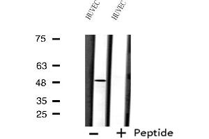 Western blot analysis of extracts from HUVEC cells using FOXD3 antibody.