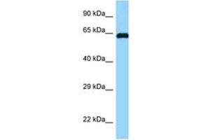 Image no. 1 for anti-Abl-Interactor 1 (ABI1) (AA 122-171) antibody (ABIN6748110) (ABI1 Antikörper  (AA 122-171))