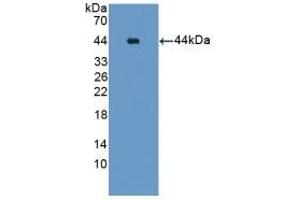Detection of Recombinant Glutamine Synthetase, Human using Polyclonal Antibody to Glutamine synthetase (GS) (GLN1 Antikörper  (AA 1-373))