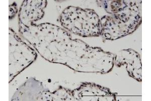 Image no. 1 for anti-MYST Histone Acetyltransferase (Monocytic Leukemia) 3 (MYST3) (AA 81-180) antibody (ABIN599471) (MYST3 Antikörper  (AA 81-180))