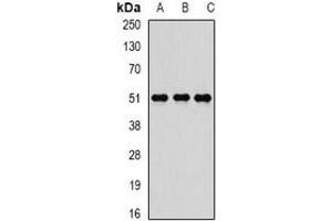 Western blot analysis of Reptin 52 expression in K562 (A), SW480 (B), MCF7 (C) whole cell lysates. (RUVBL2 Antikörper)