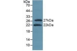 Detection of Recombinant ATF4, Mouse using Polyclonal Antibody to Activating Transcription Factor 4 (ATF4) (ATF4 Antikörper  (AA 126-291))