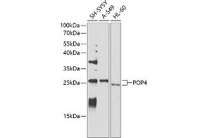 Western Blotting (WB) image for anti-Processing of Precursor 4, Ribonuclease P/MRP Subunit (POP4) (AA 1-220) antibody (ABIN6145964)