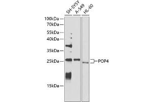 Western blot analysis of extracts of various cell lines, using POP4 antibody (ABIN6128482, ABIN6145964, ABIN6145966 and ABIN6220640) at 1:1000 dilution. (RPP29 Antikörper  (AA 1-220))