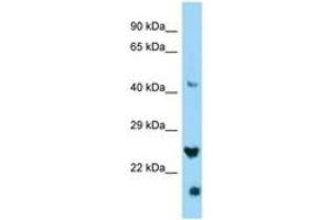 Image no. 1 for anti-IZUMO Family Member 4 (IZUMO4) (C-Term) antibody (ABIN6748351) (IZUMO4 Antikörper  (C-Term))