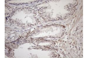 Immunohistochemistry (IHC) image for anti-Achalasia, Adrenocortical Insufficiency, Alacrimia (AAAS) (AA 322-546) antibody (ABIN2715861) (Adracalin Antikörper  (AA 322-546))