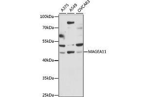 Western blot analysis of extracts of various cell lines, using MAGEA11 antibody (ABIN6290619) at 1:1000 dilution. (MAGEA11 Antikörper)