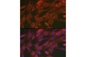 Immunofluorescence (IF) image for anti-Superoxide Dismutase 2, Mitochondrial (SOD2) (AA 25-222) antibody (ABIN3021904)