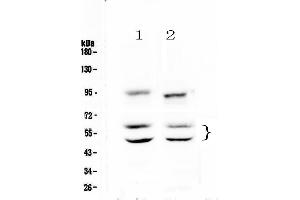 Western blot analysis of CaMKII alpha using anti-CaMKII alpha antibody .