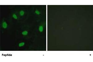Immunofluorescence analysis of HeLa cells, using TBX15/TBX18 polyclonal antibody . (T-Box 15 Antikörper)