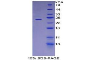 SDS-PAGE (SDS) image for Perilipin 2 (PLIN2) (AA 245-433) protein (His tag) (ABIN1879484)