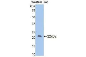 Western Blotting (WB) image for anti-Slit Homolog 2 (Drosophila) (SLIT2) (AA 209-374) antibody (ABIN1173404) (SLIT2 Antikörper  (AA 209-374))