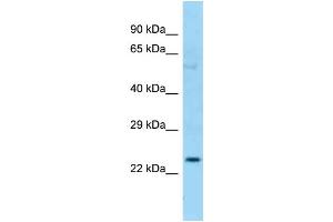 Host: Rabbit Target Name: CFHR2 Sample Type: OVCAR-3 Whole cell lysates Antibody Dilution: 1. (CFHR2 Antikörper  (C-Term))